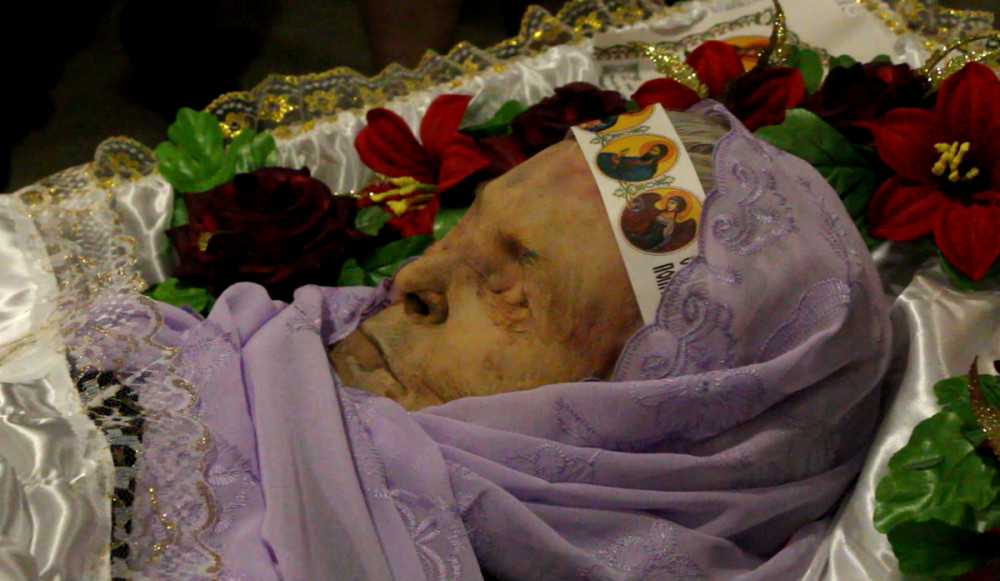 За три дня в морге СМЭ тело умершей женщины разложилось практически полснотью.