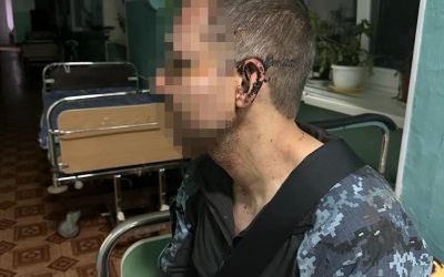 На Одещині побили військового