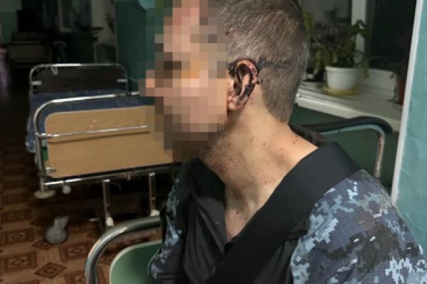 На Одещині побили військового